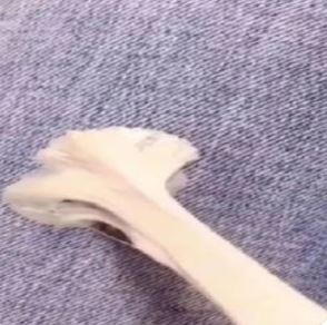 Removing gum from canvas shoes